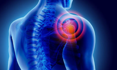Arthroscopic Nerve Release
